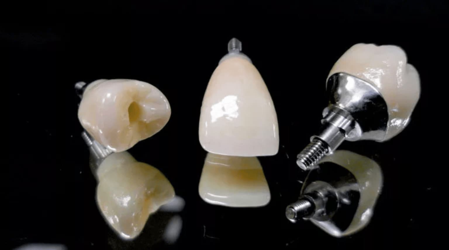 Акция !!! Циркониевая коронка на имплантате (Osstem) 